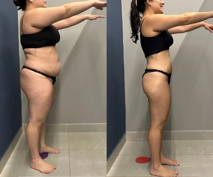 Antes e depois de aluna: Resultado de 10 meses de treino