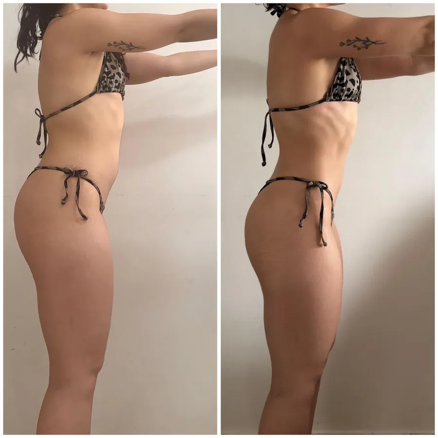 Antes e depois de aluna: Resultado de 5 meses de treino